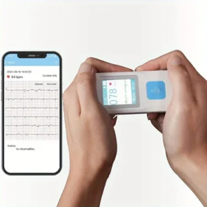 ECG Monitor Portable EKG Monitor